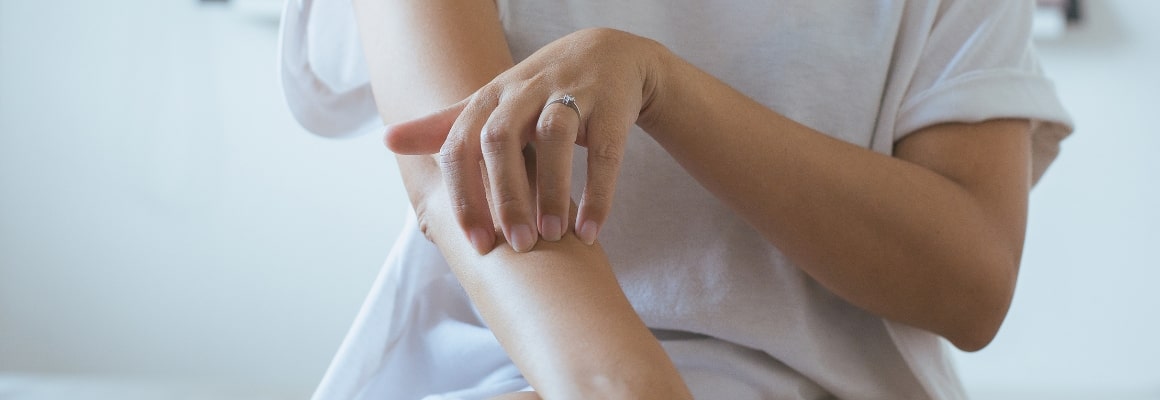 Woman scratching her arm.