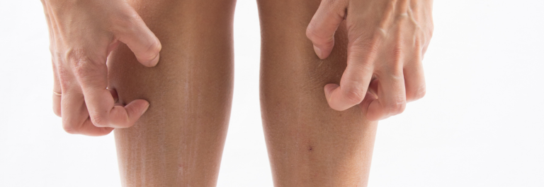person scratching skin on their lower legs