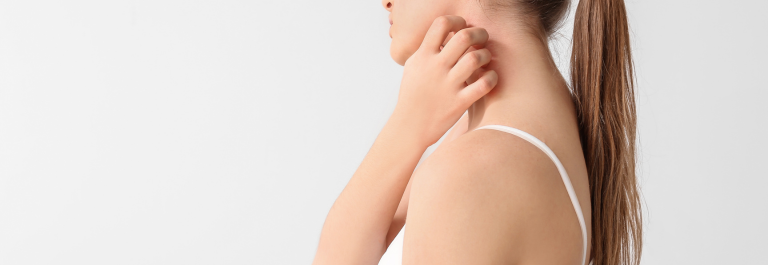 woman scratching Neurodermatitis on neck
