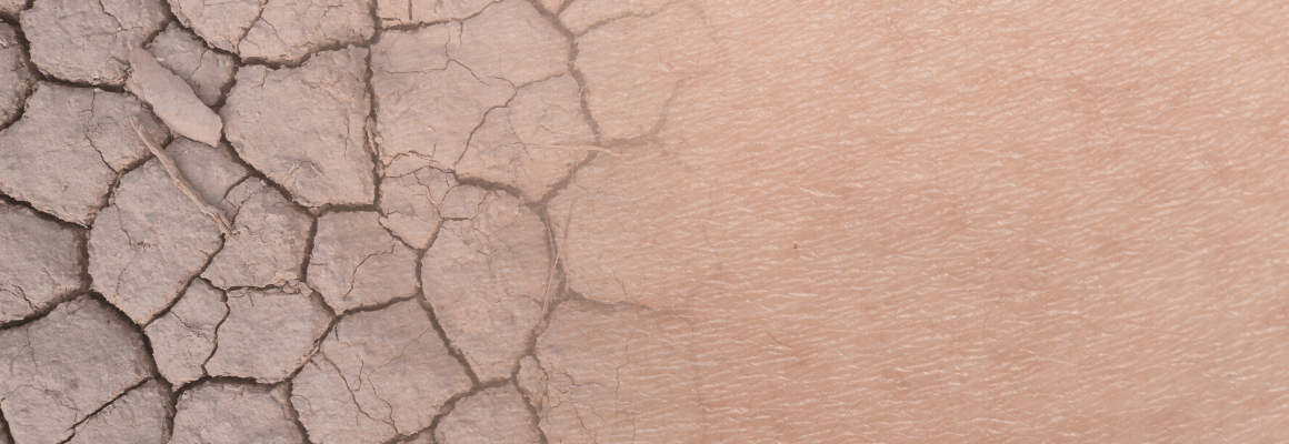 really close up dry skin