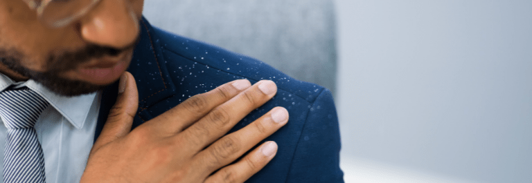man wiping dandruff off shoulder