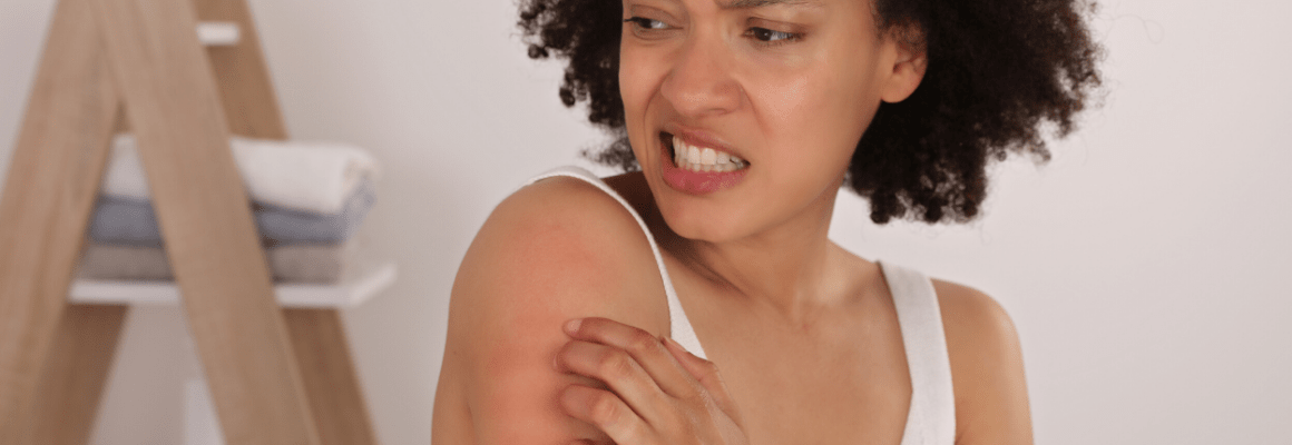woman in white tank top scratching arm