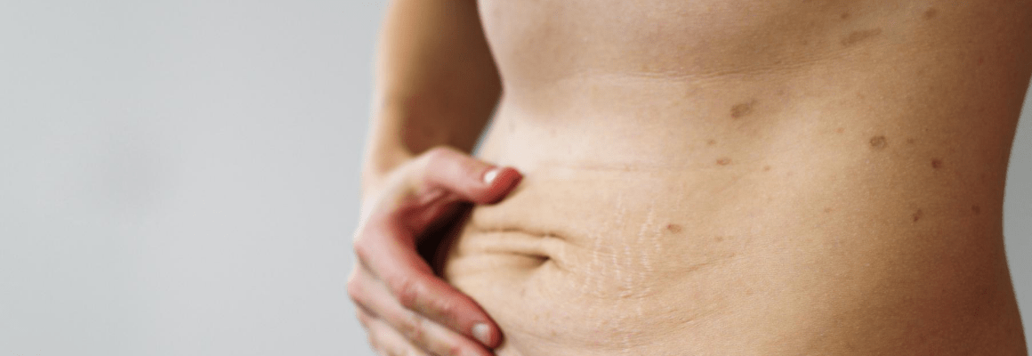 woman holding hands on stomach