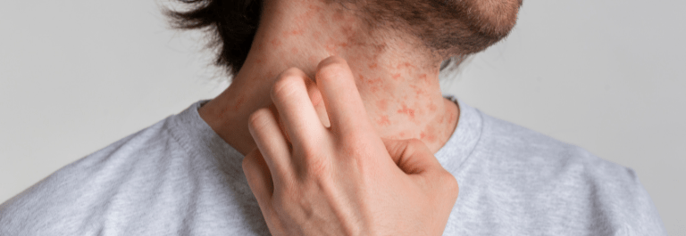 man scratching his neck