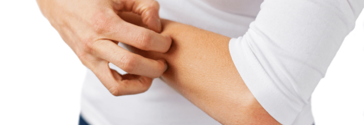 woman in white shirt scratching arm
