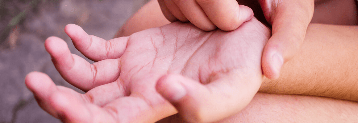 person scratching their open palm