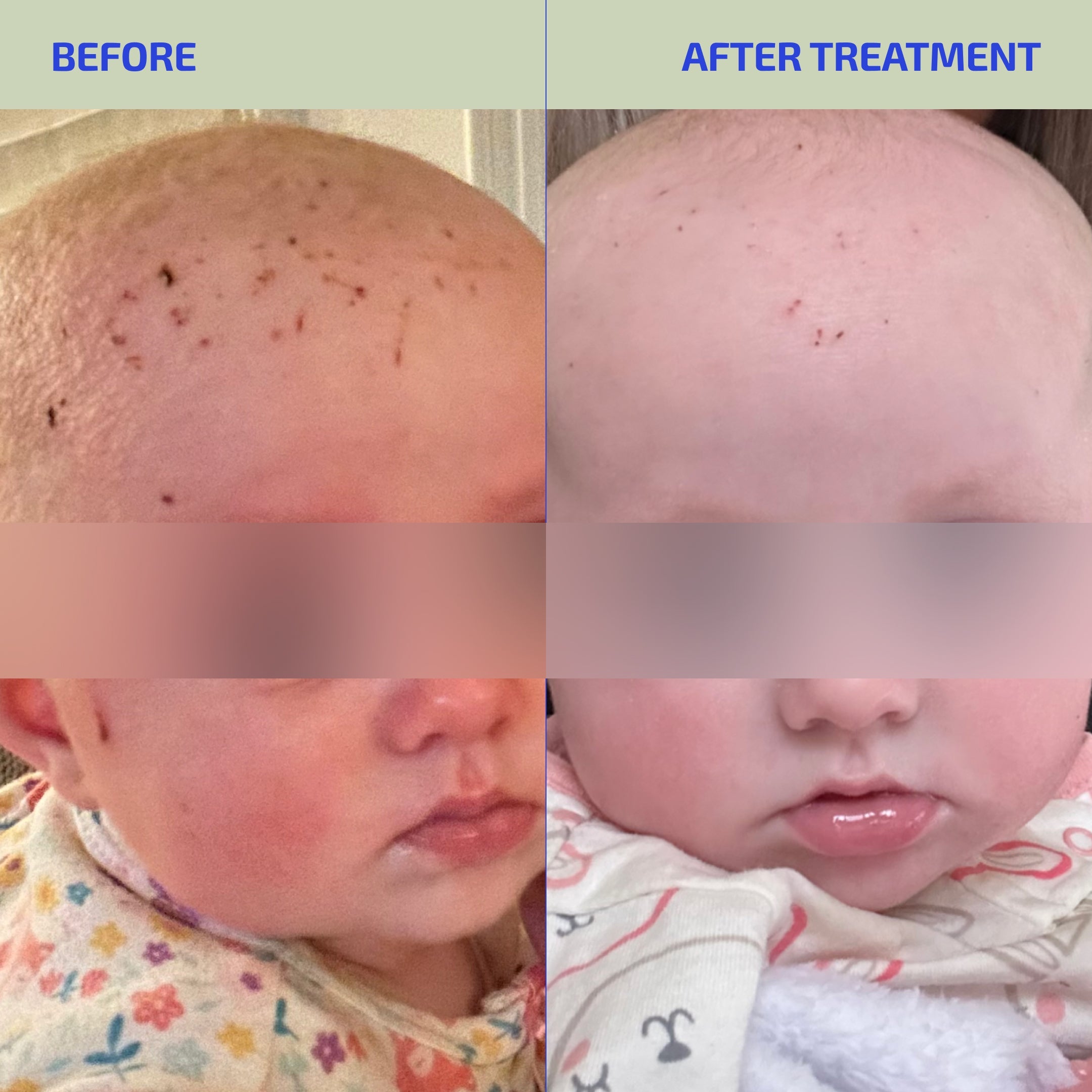 BIA Infant & Toddler Skin Barrier Supplement (Age 3M-3Y)