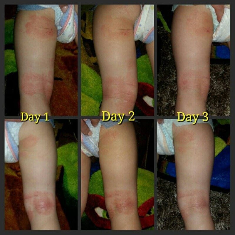 Soothe My Skin Emu Oil Cream: The Ultimate Healing Solution for Your Skin