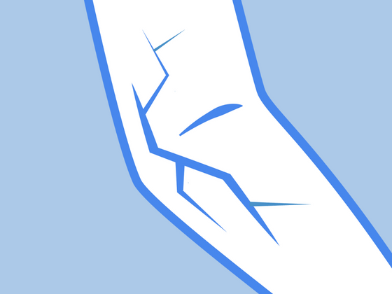 Scaly Eczema Illustration