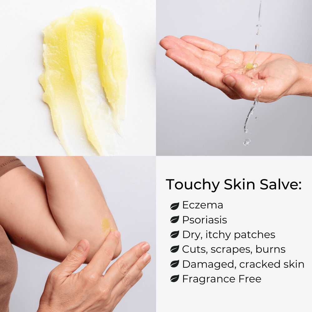 Ora's Amazing Touchy Skin Salve