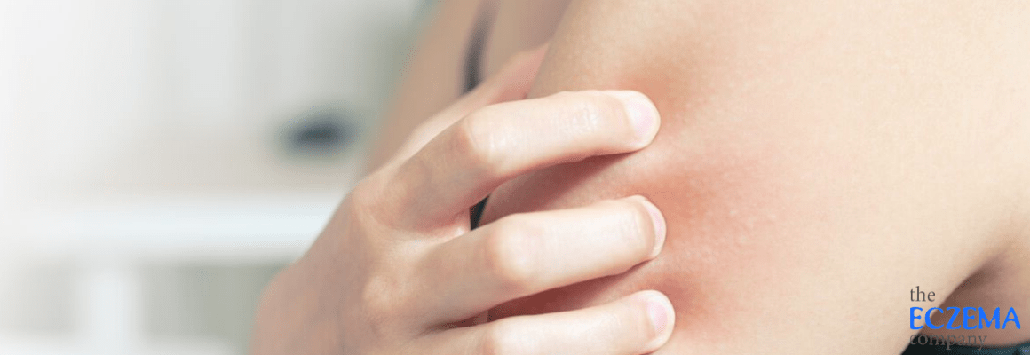 person scratching their upper arm