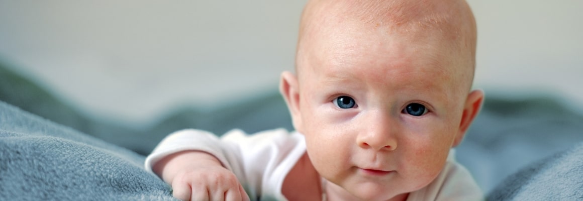 Infant with splotchy eczema on the forehead.