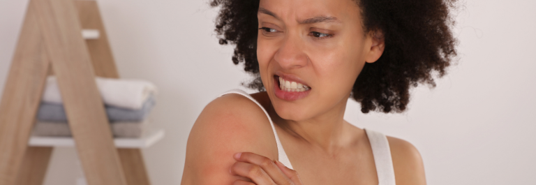 black woman scratching itchy eczema on arm
