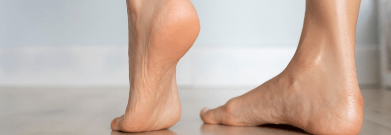 eczema on bottom of feet - woman lifting foot