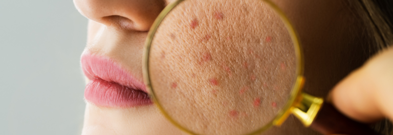 magnifying glass up against a woman's cheek