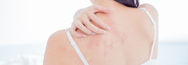 Woman scratching her back 
