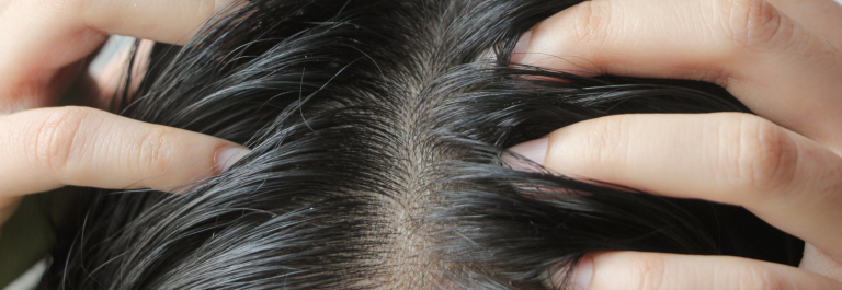 fingers scratching the scalp of a head of dark hair 