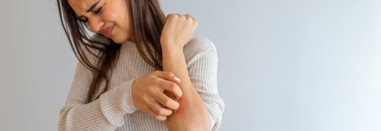 woman scratching at irritated, red skin on arm