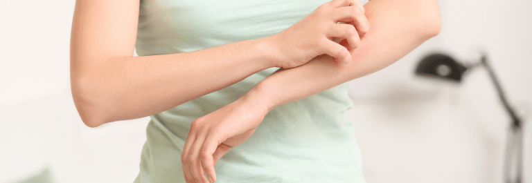 person scratching arm
