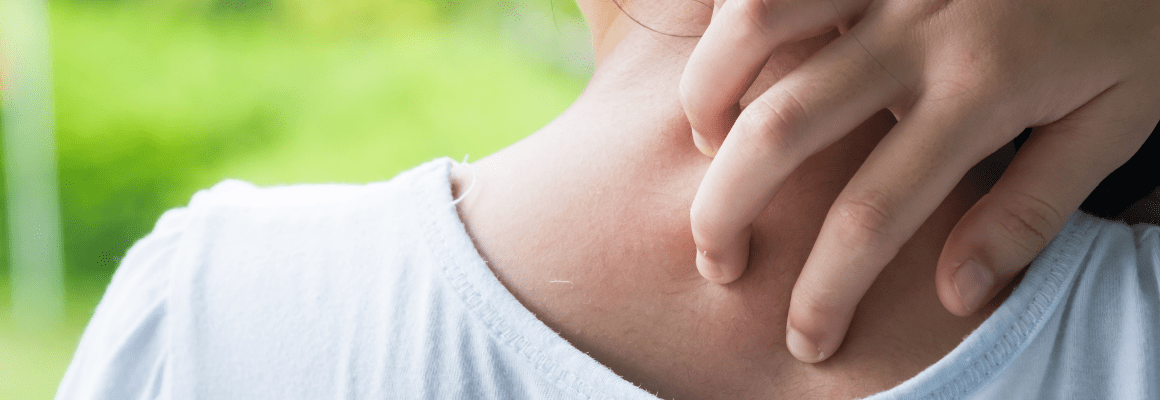 woman scratching back of neck