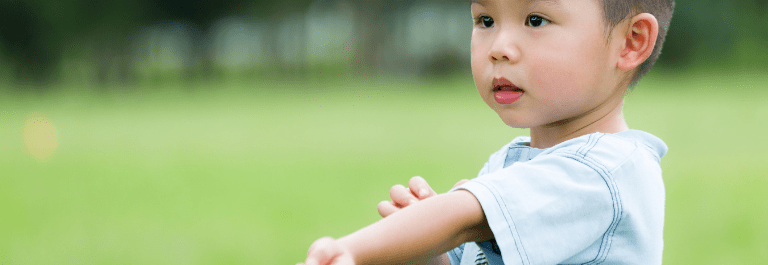 little boy scratching arm