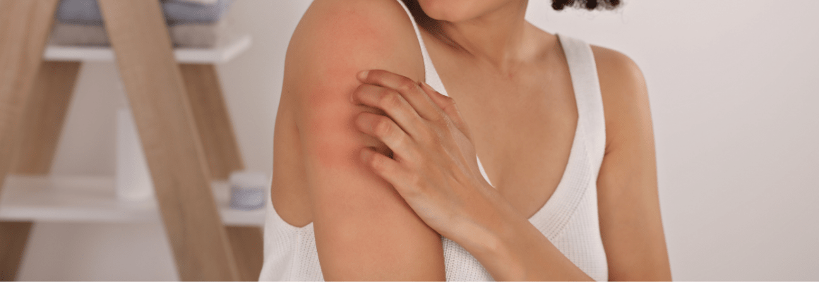 woman in white tanktop scratching upper arm
