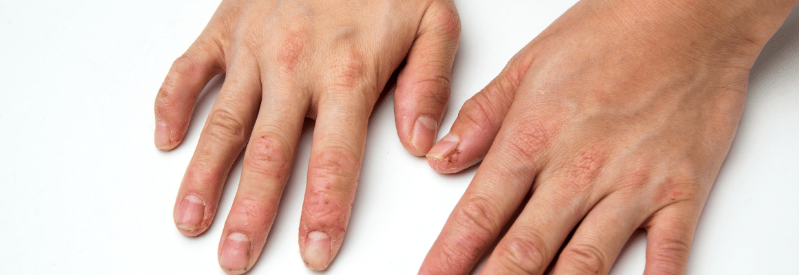 person with hands flat down on surface