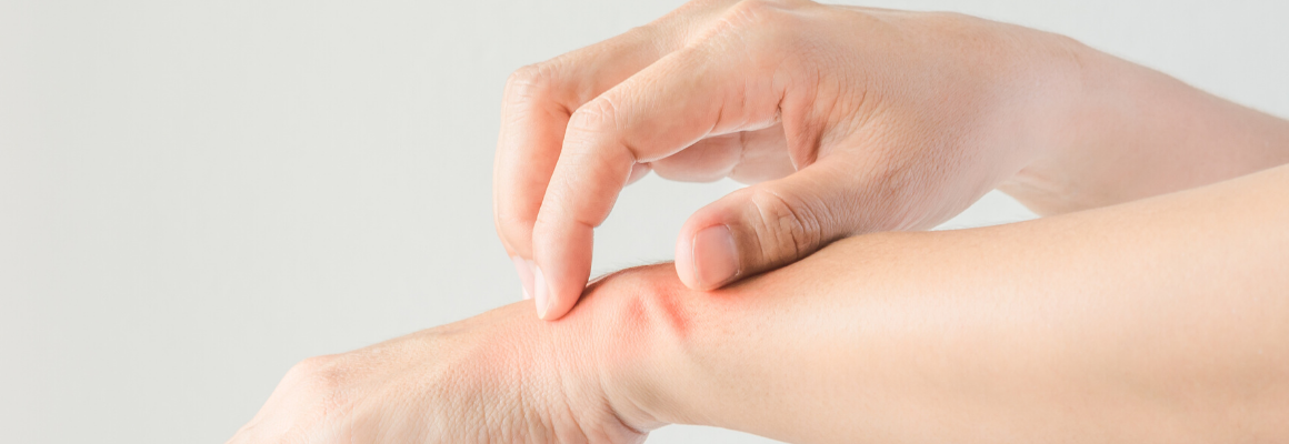 close up shot of person scratching their hand