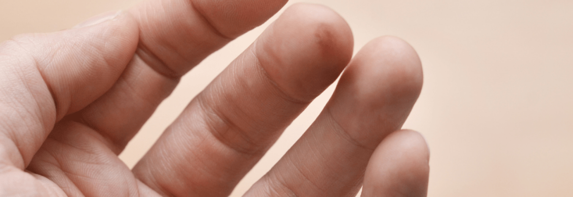 cracked fingertips