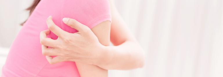 woman scratching skin - itchy skin