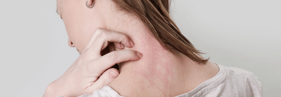 backview of woman scratching neck