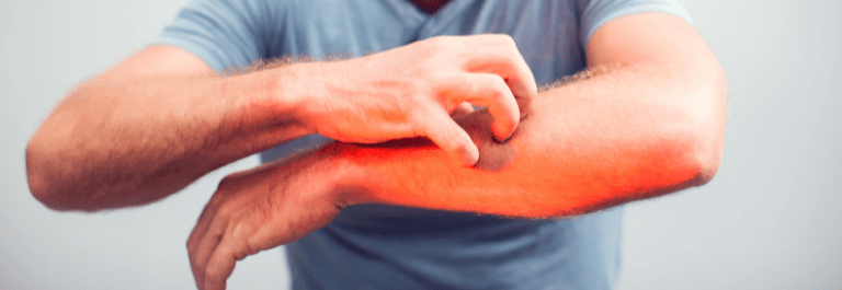 man scratching his arm