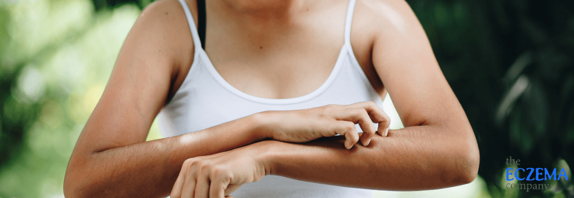 woman in white tank top scratching arm