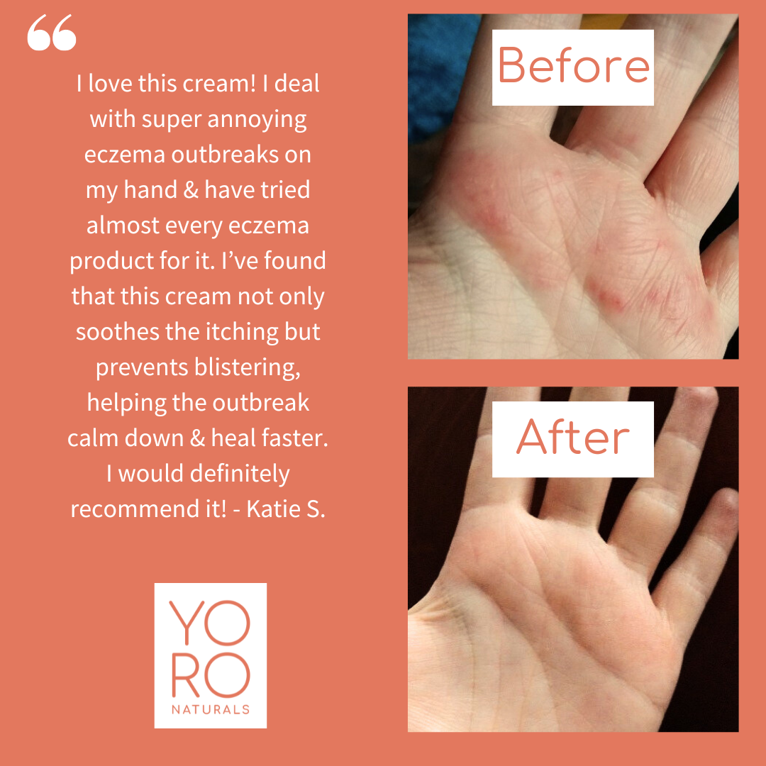 Organic Manuka Skin Soothing Cream by YoRo Naturals